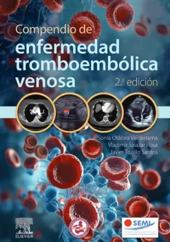 Ciencias De La Salud*Elsevier Compendio de enfermedad tromboembólica venosa 2ª Ed.