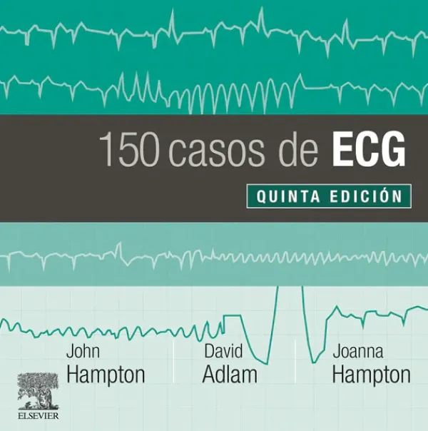 Ciencias De La Salud*Elsevier 150 problemas de ECG 5ª Ed.
